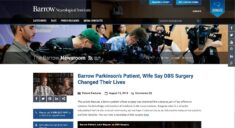 Live streaming brain surgery transforms the patient experience 3 The Barrow Newsroom features live surgery video.